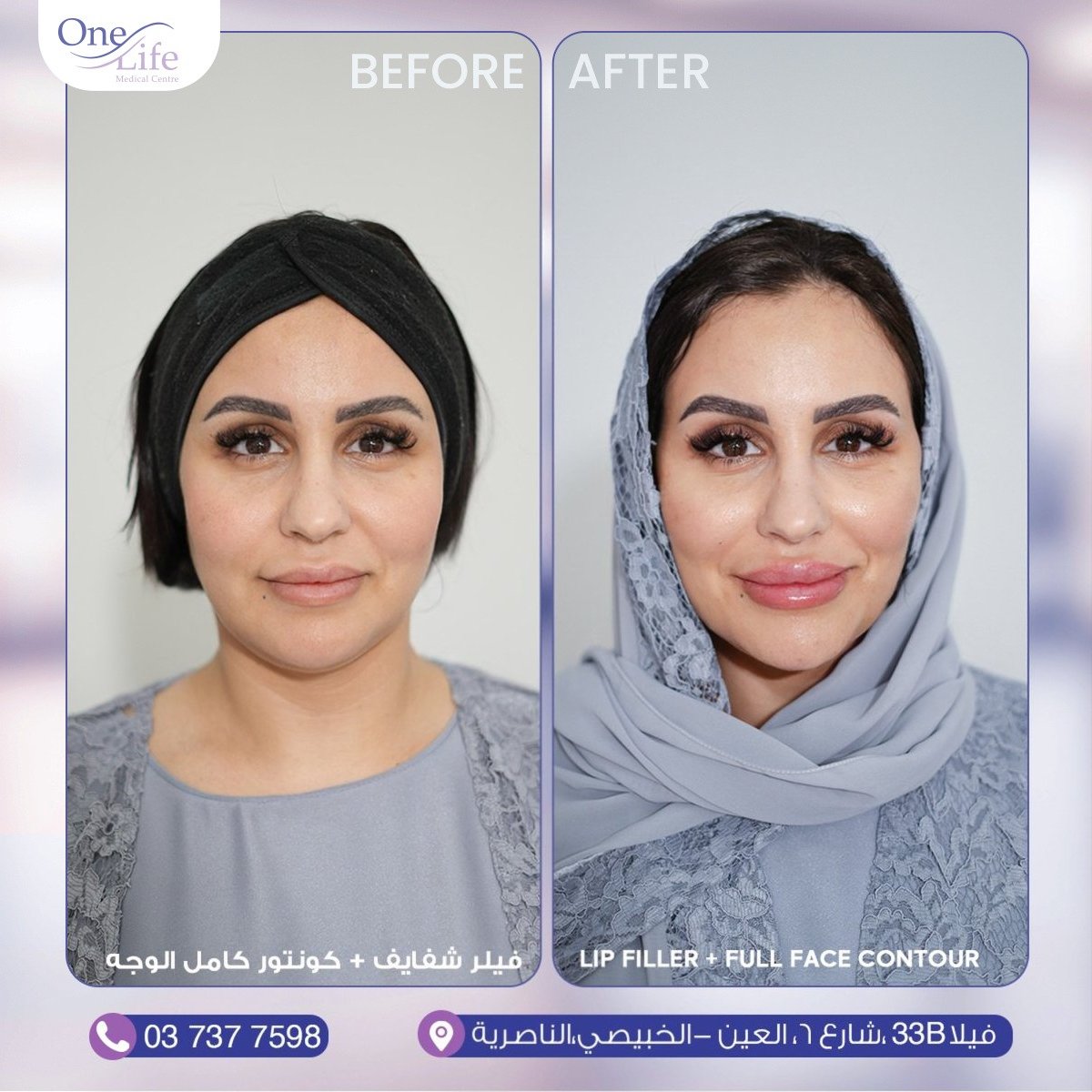 before and after (One Life Medical) (1)