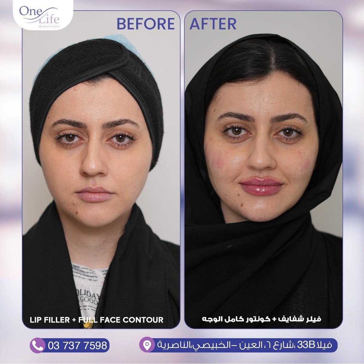 before and after (One Life Medical) (5)